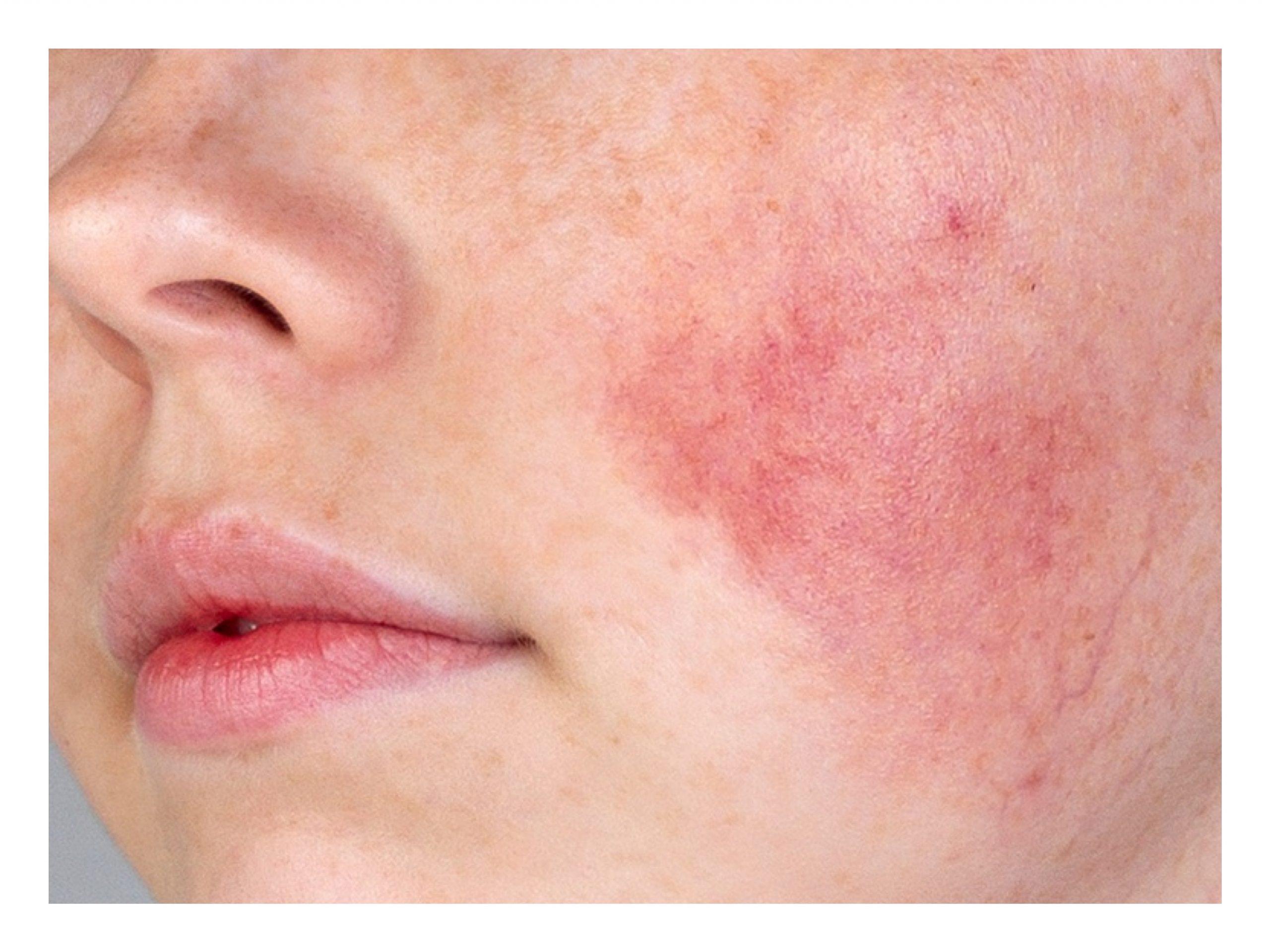 Understanding‍ the Soothing Benefits for Sensitive Skin